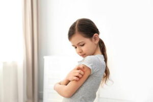 When a Simple Rash Might Need a Medical Evaluation